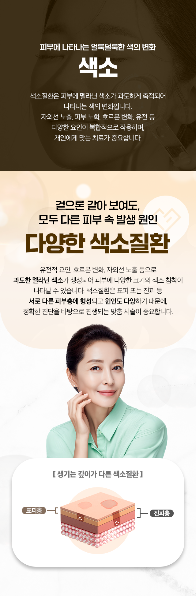 피부에 나타나는 얼룩덜룩한 색의 변화-색소-겉으론 같아 보여도, 모두 다른 피부 속 발생 원인-다양한 색소질환