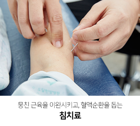 뭉친-근육을-이완시키고,-혈액순환을-돕는-침치료