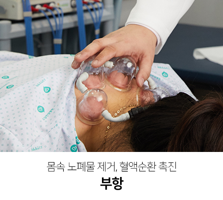 몸속-노폐물-제거,-혈액순환-촉진-부항