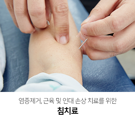 염증제거,-근육-및-인대-손상-치료를-위한-침치료