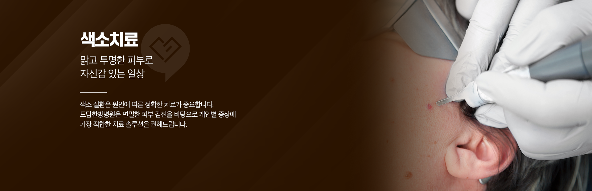 색소치료-맑고 투명한 피부로-자신감 있는 일상